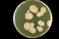Agar Plate Culture of Candida albicans